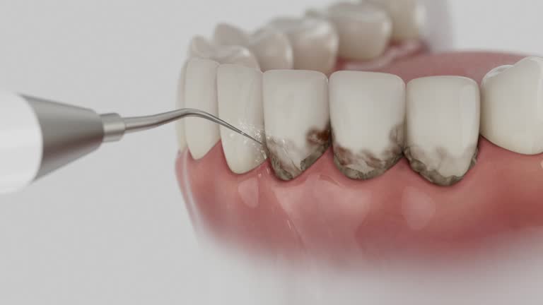 Trusted Root Canal Treatment service in Gladwin, MI - Dentist Open Now